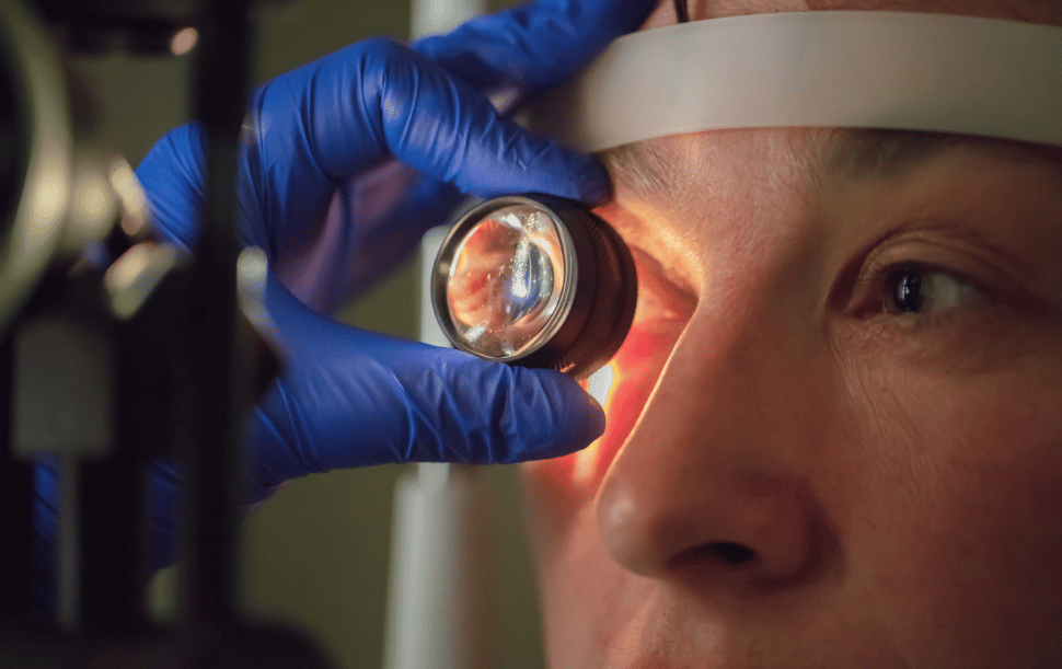 Glaucoma-Management