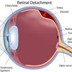 retinal