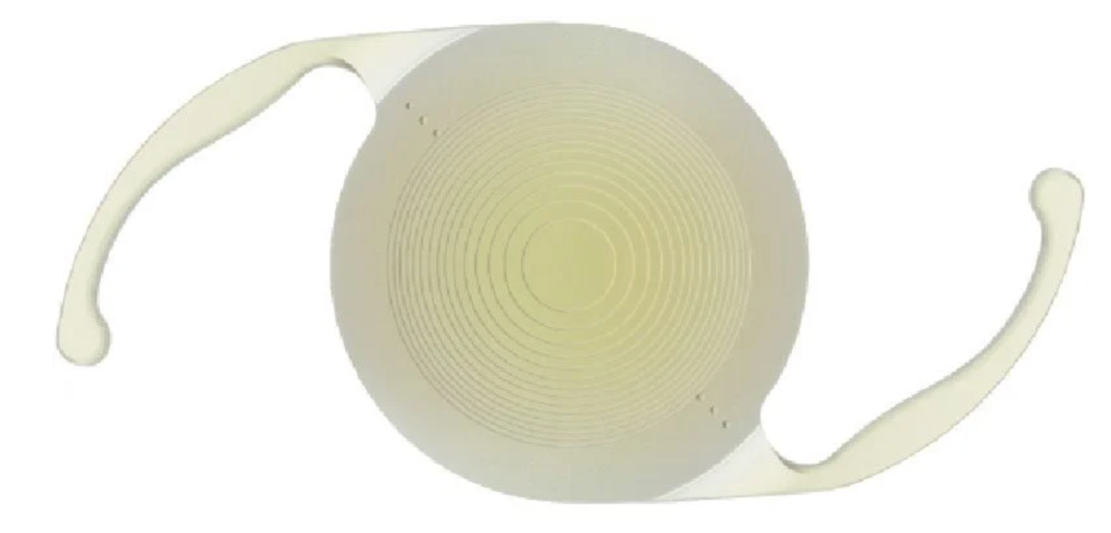 "Close-up of a multifocal intraocular lens (IOL) with concentric rings and stabilizing haptics, used in cataract surgery to restore vision at multiple distances."