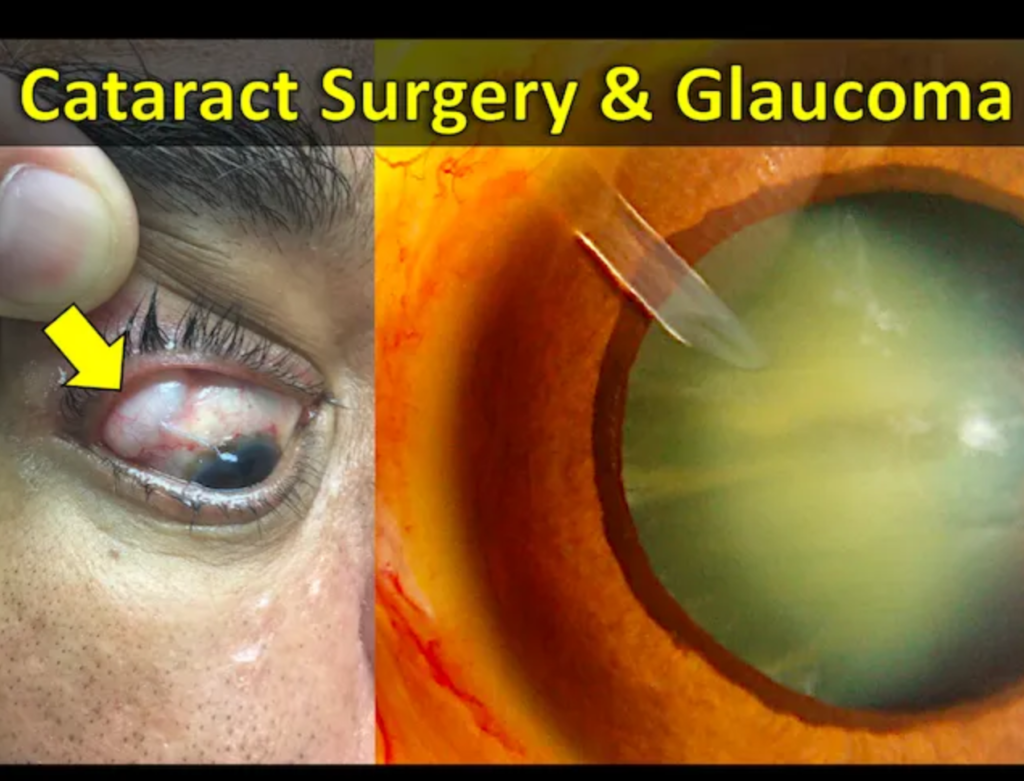 Crystal Clear Eye Clinic Crystal Clear Eye Clinic Best Eye Clinic in Andheri Mumbai