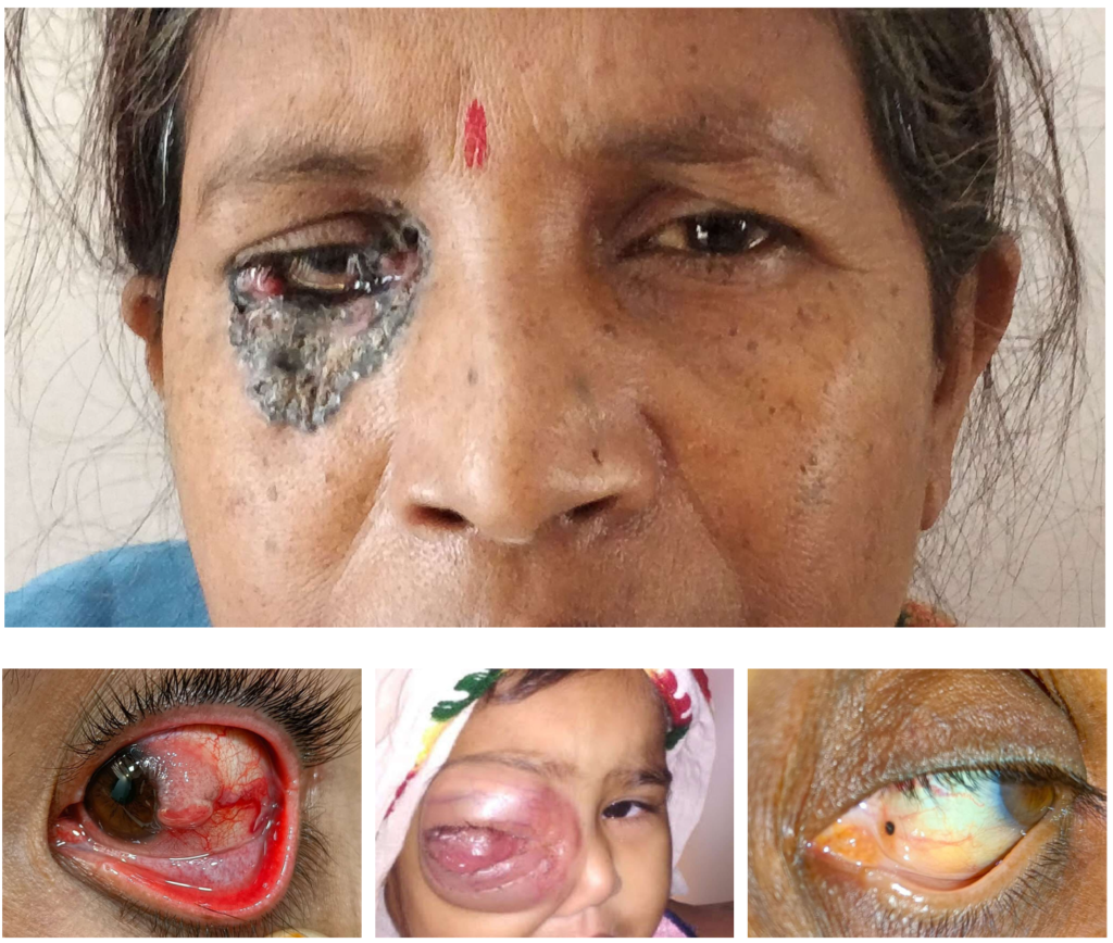 Crystal Clear Eye Clinic Crystal Clear Eye Clinic Best Eye Clinic in Andheri Mumbai