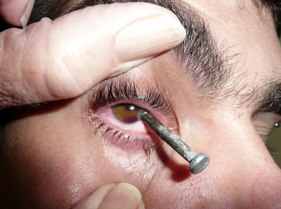 Crystal Clear Eye Clinic Crystal Clear Eye Clinic Best Eye Clinic in Andheri Mumbai