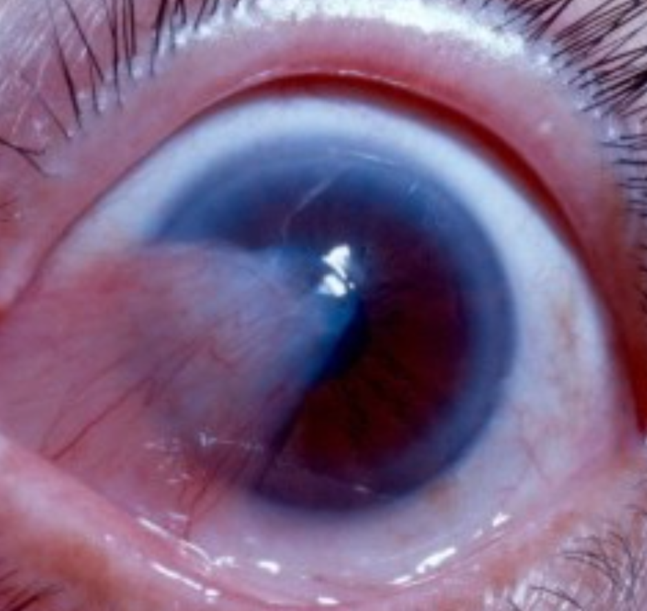 Crystal Clear Eye Clinic Crystal Clear Eye Clinic Best Eye Clinic in Andheri Mumbai