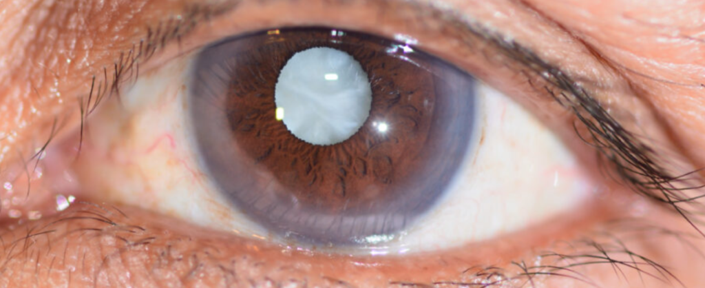 Crystal Clear Eye Clinic Crystal Clear Eye Clinic Best Eye Clinic in Andheri Mumbai