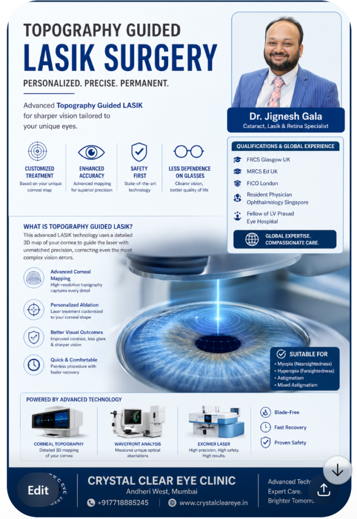 Topography Guided lasik explained by DrJignesh Gala