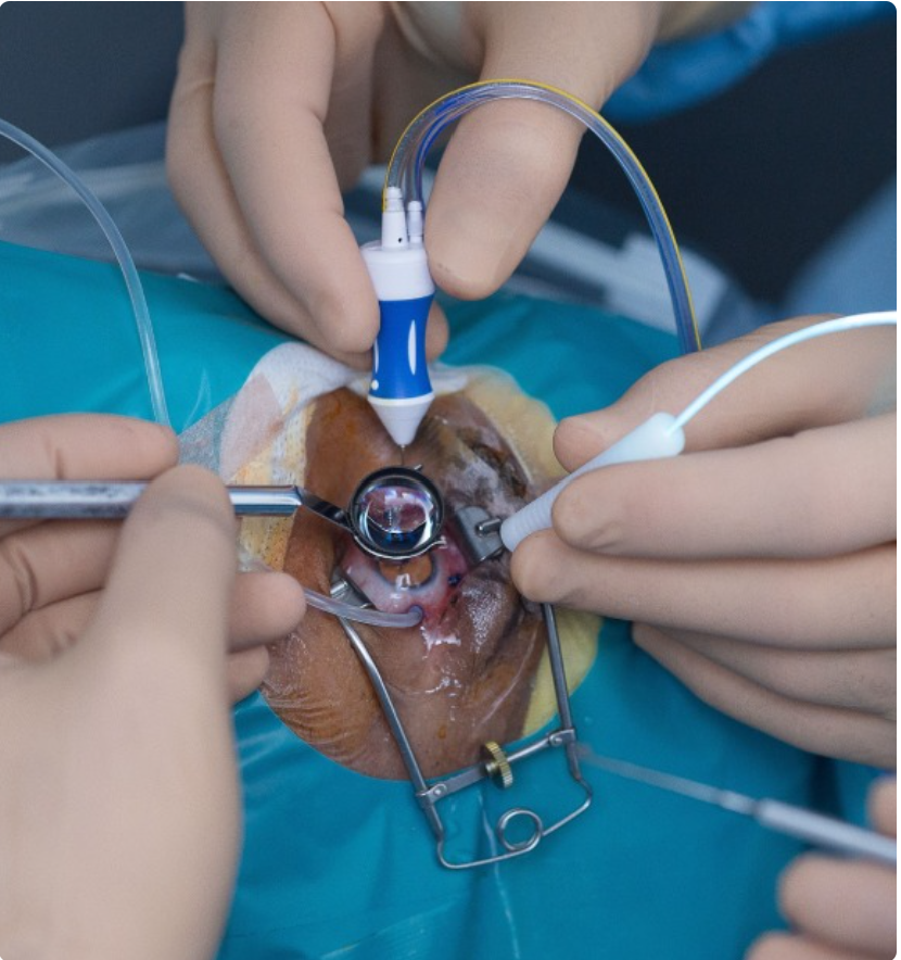 Crystal Clear Eye Clinic Crystal Clear Eye Clinic Best Eye Clinic in Andheri Mumbai