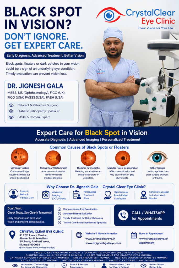 black spot in vision black spot in vision is explained by Dr.Jignesh Gala