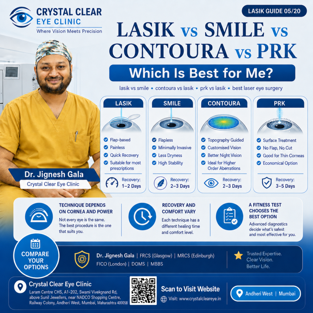 Lasik vs smile vs contoura vs prk by DrJignesh gala Crystal Clear Eye Clinic Best Eye Clinic in Andheri Mumbai Lasik vs smile vs contoura vs prk by DrJignesh gala