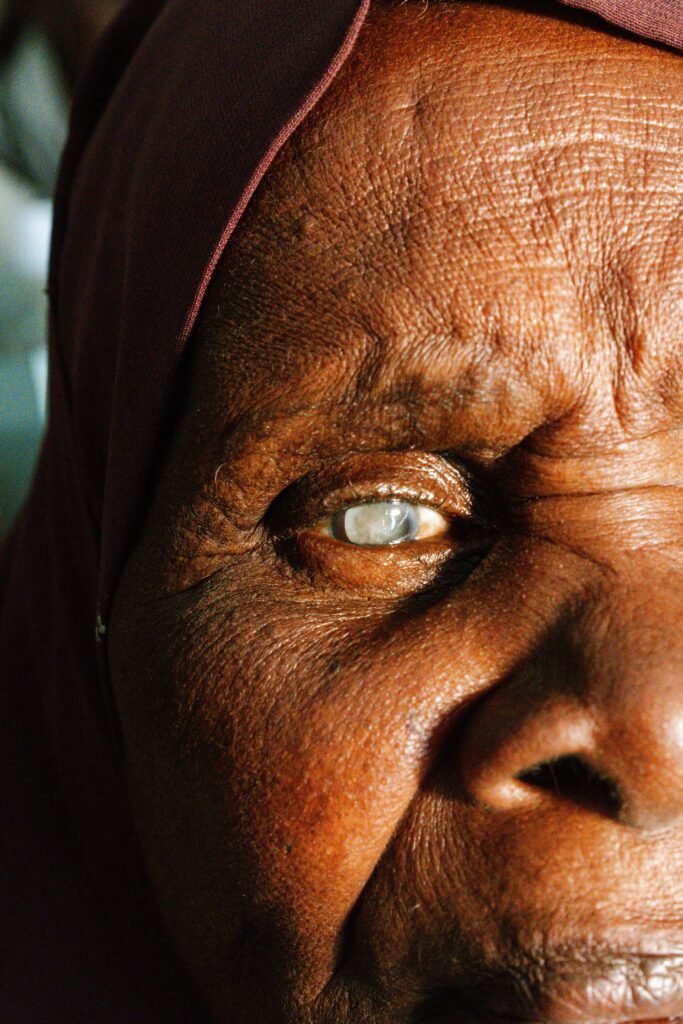 Detailed close up of an elderly womans eye affected by cataract showcasing texture and emotion